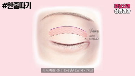 두줄따기 제대로 알아보자