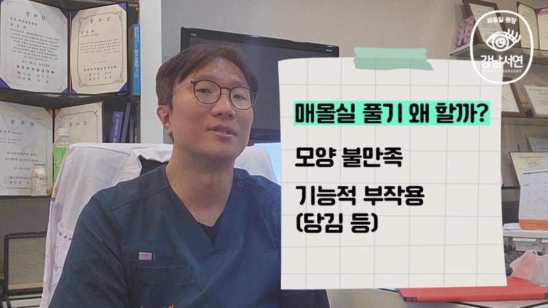 매몰실 풀기, 매몰실 제거 다양한 케이스 성공 후기